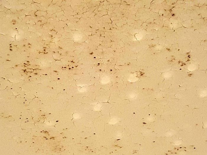 Killing Mold on Porous Surfaces. Spray Problem Areas With Vinegar to Kill Mold